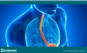 Existe-cirurgia-para-refluxo-gastroesofagico-Dr-Fabio-Atui-03-08-2015