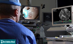 Endoscopia - Por Dr. Fabio Atui