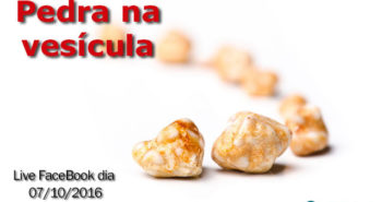 Live FaceBook Pedra na Vesícula - Por Dr Fabio Atui - Cirurgia do Aparelho Digestivo e Coloproctologista