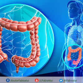 Câncer de intestino - Por Dr Fabio Atui - Cirurgia do Aparelho Digestivo e Coloproctologista