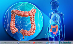 Câncer de intestino - Por Dr Fabio Atui - Cirurgia do Aparelho Digestivo e Coloproctologista