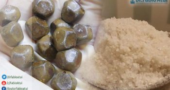 Pedra na Vesícula - Por Dr Fabio Atui - Cirurgia do Aparelho Digestivo e Coloproctologista