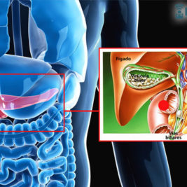 Retirada da vesícula biliar - Por Dr Fabio Atui - Cirurgia do Aparelho Digestivo e Coloproctologista